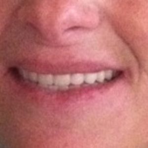 teeth