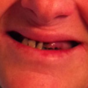 teeth